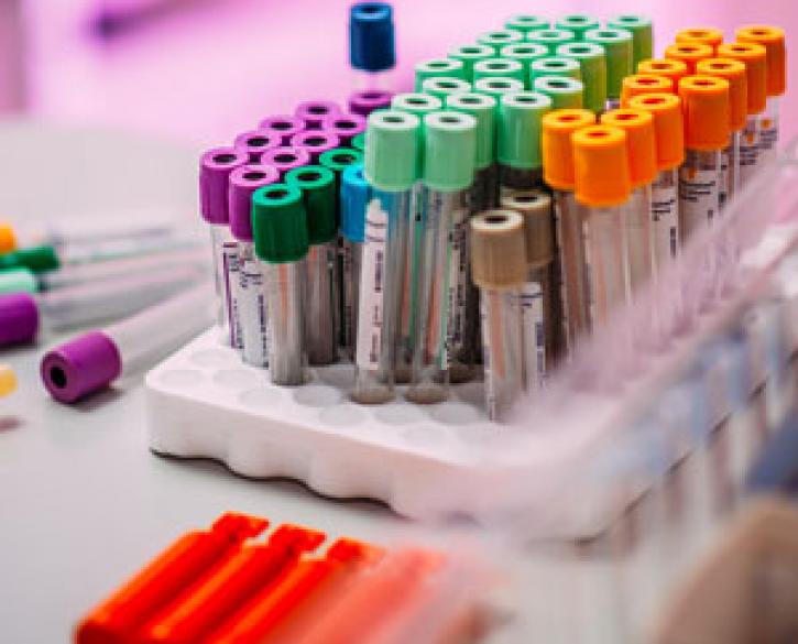Stamceltransplantatie in de strijd tegen MS