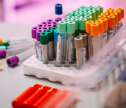 Stamceltransplantatie in de strijd tegen MS